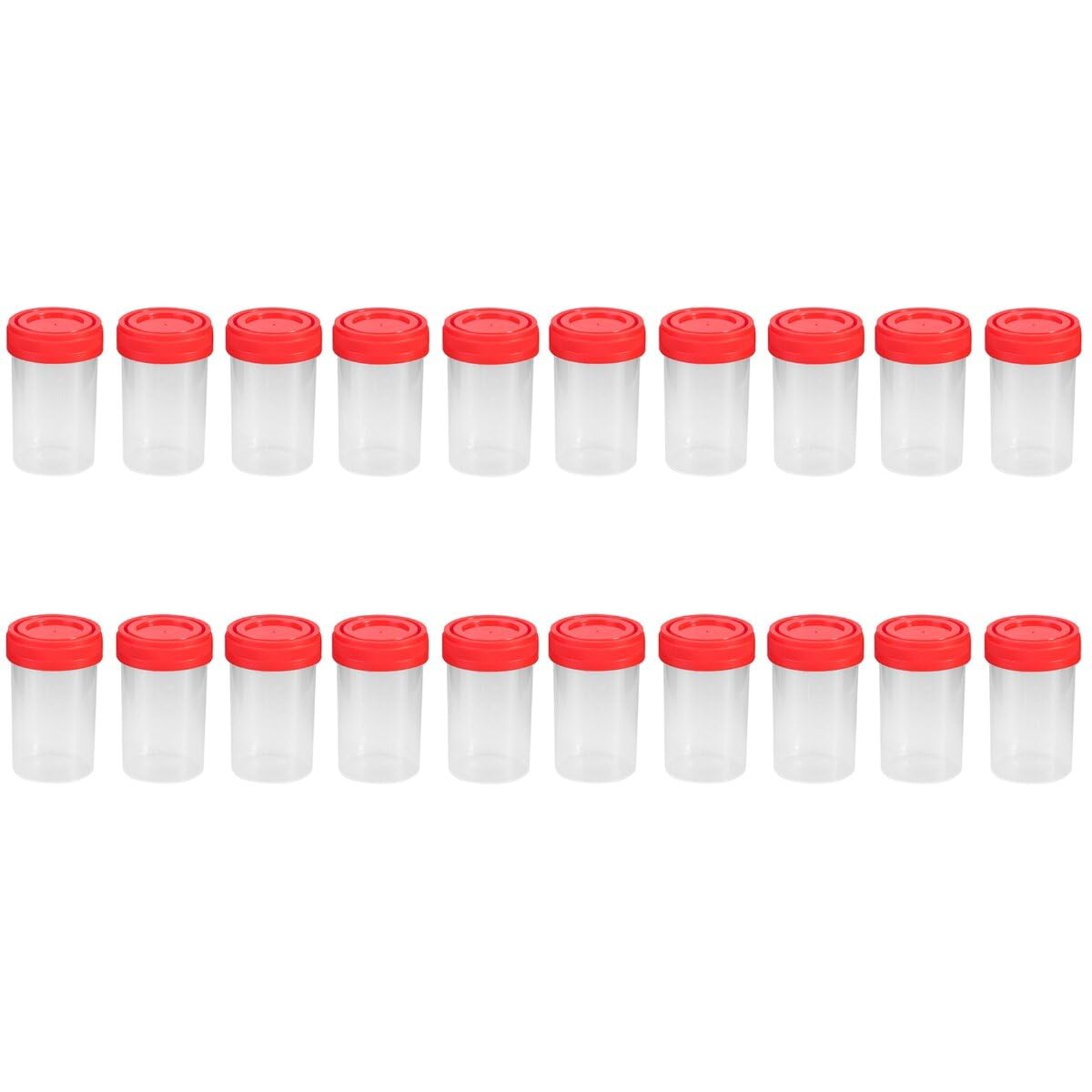 VILLCASE 20pcs Specimen Cups, 60ml Clear Specimen Liquid Container Sample Pots, Scientific Plastic Sample Jar with Lids, Easy to Fill and Secure, Ideal for Lab Testing (Random Color)