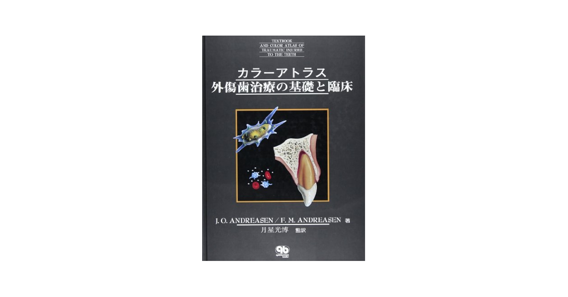 カラ-アトラス外傷歯治療の基礎と臨床   /クインテッセンス出版/Ｊ．Ｏ．アンドレアセン（単行本） カラ-アトラス 外傷歯治療の基礎と臨床 |本 | 通販 | Amazon