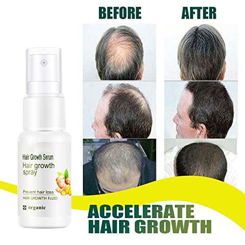 Hair Growth Serum,Hair Growth Spray and Enhancer,Thickening Hair Spray & Scalp Hair Care,Repairs Hair Follicles Hair Serums for Hair Growth,Anti Hair Loss Hair Regrowth Treatment for Women & Men,20ML - Image 4