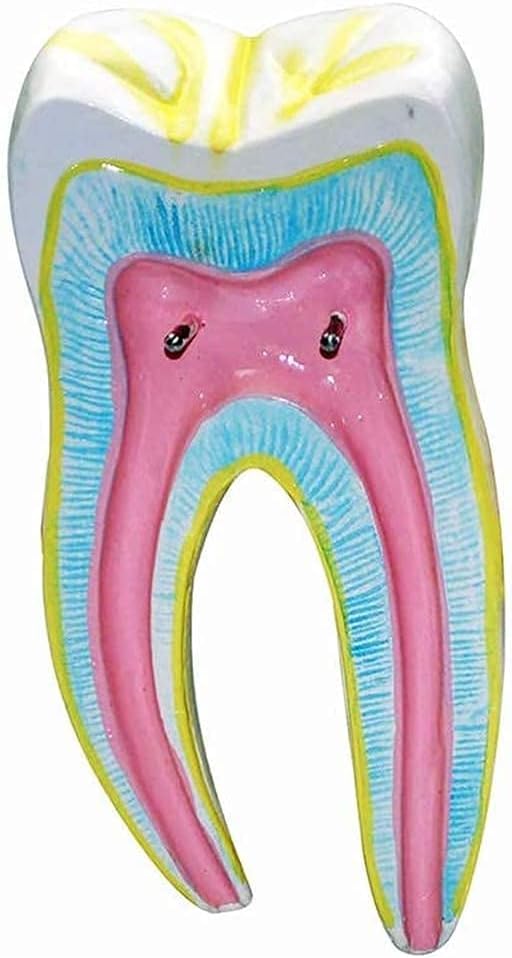 ERNZI Modèle Dentaire, Démonstration Biomédicale Enseignement De Anatomie des Dents Humaines, Modèle De Carie Dentaire Molaire, Modèle Enseignement Standard pour Adultes