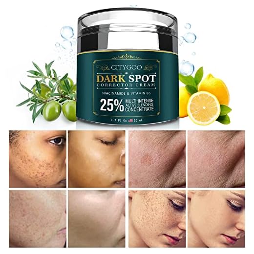 CITYGOO Dark Spot Remover for Face and Body, Dark Spot Corrector Cream, Natural Ingredient,Enriching Skin Care For All Skin Tones - Melasma, Freckle, Sun Spot Remover & Blemish Reducer-1.7 FL OZ