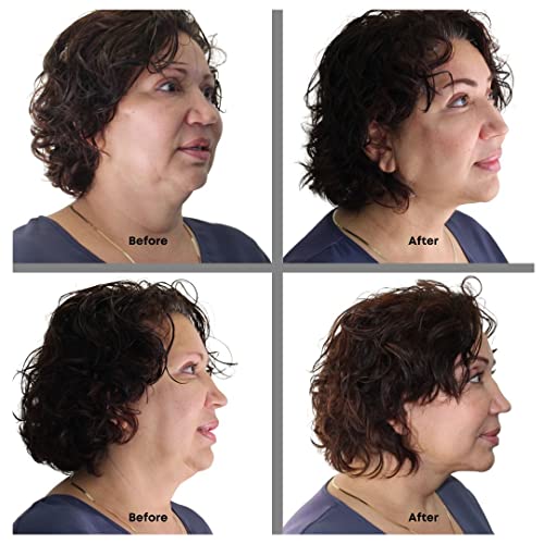 Bring It Up Instant Neck Lift #TOP1