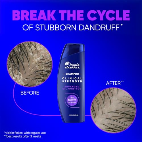 Head & Shoulders Anti-Dandruff Shampoo with 1% Selenium Sulfide, Clinical Strength Advanced Oil Control Twin Pack, Seborrheic Dermatitis Relief, Oily Scalp, 13.5 Fl Oz - Image 7