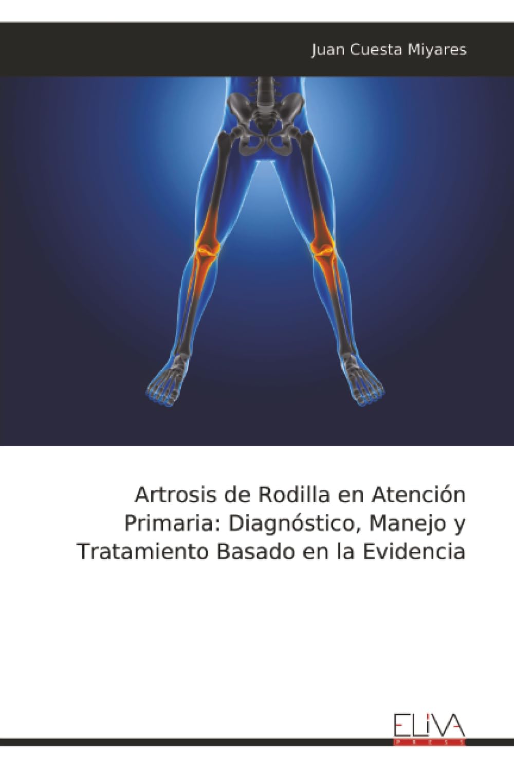 Artrosis de Rodilla en Atención Primaria: Diagnóstico, Manejo y Tratamiento Basado en la Evidencia
