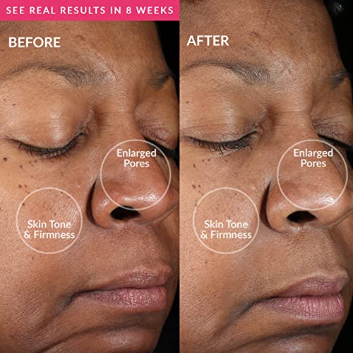 Pmd Clean Mini - Smart Facial Cleansing Device With Silicone Brush & Anti-Aging Massager - Waterproof - Sonicglow Vibration Technology - Clear Pores And Blackheads - Lift, Firm, And Tone Skin #TOP3