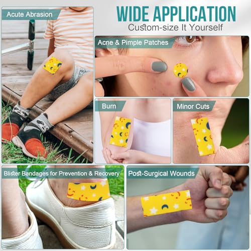 Image of Hydrocolloid Roll for Wound Care, Pimple Patch Roll Tape with Self-Adhesive, Bed Sore Bandages, Highly Absorbent for Burn, Blister, Acne Care, Waterproof (2in x 8ft) -Yellow