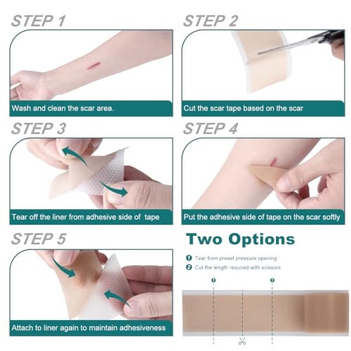 Image of Silicone Scar Sheets, Silicone Scar Tape (1.6 inchx 60 inch Roll-1.5M)