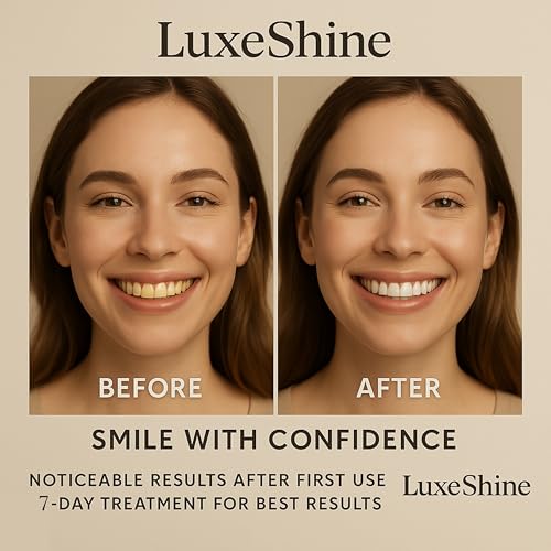 Image of Teeth Whitening Strips - Dry Strip Technology, 14 Strips for Tooth Whitening & Sensitive Teeth, Enamel-Safe & Professional Whitening Strips - Removes Stubborn Stains