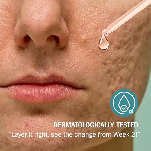Image of 7DAYSNATURAL Retinol Face Serum | 0.5% Retinol with Lactic Acid & Vitamin E | Night Serum for Wrinkles, Fine Lines & Scars | Oily to Combination Skin | 30ml