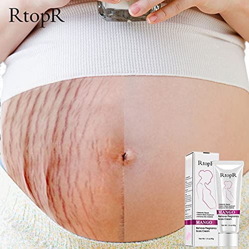 Reddhoon 2 Pack Mango Stretch Marks Scar Cream, Stretch Marks Treatment, Maternity Repair, Recovery Elasticity, Repair Scar Slack Line Abdomen Stretch Marks Postpartum #TOP3