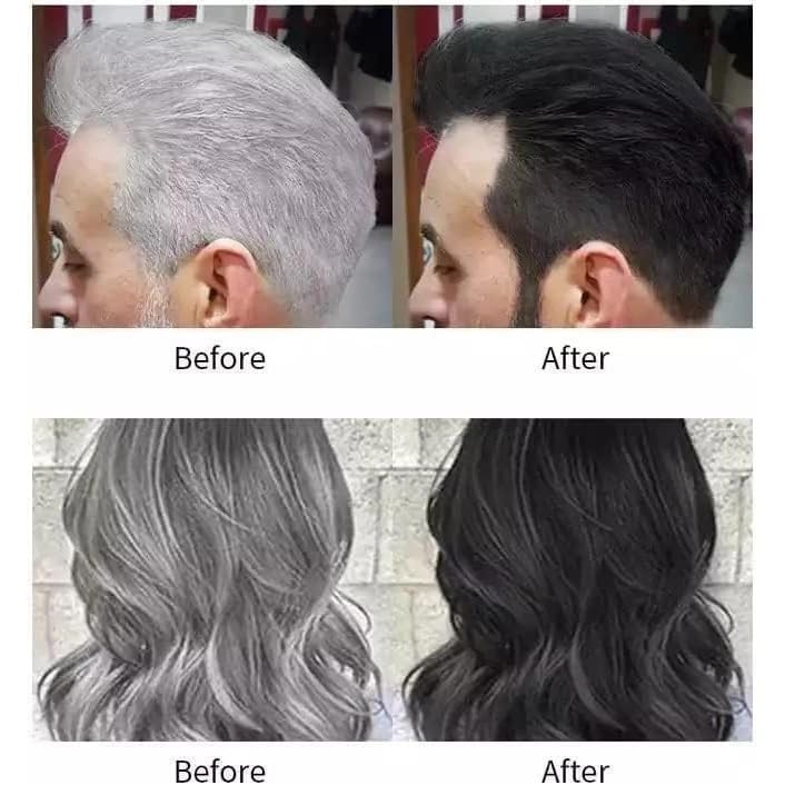 Image of Apple Natural Black Hair Fruit Vinegar Hair Dye Color For Both Men Women Ammonia Free Color Gel Hair Black Gel 200 Ml Original Beaute Black Cover Gray Hair Gel