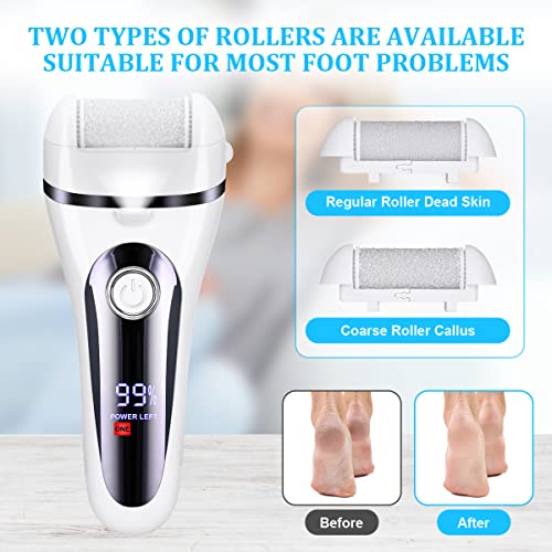 ACWOO Elektrischer Rasierer für Frauen, 4 in 1Epilierer Damen, Aufsätze für Rasierer und Elektrischer Hornhautentferner für Fußpflege, schmerzfreier Haartrimmer für Gesicht, Arm, Bein, Bikinizone - Image 7