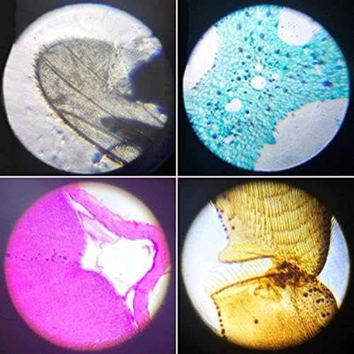 Science Kits for Kids Beginner Microscope with LED 100X 400X and 1200X-Include Sample Prepared Slides 12pc- Educational Toy for School Usage, Early Education for Kid Home Usage Birthday 5 51lNImIE4FS. AC
