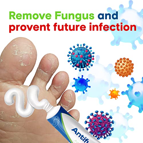 CHARMPOO Antifungal Cream Athletes Foot Antifungal