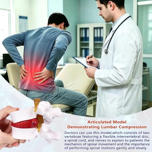 Image of Human Anatomical Lumbar Herniation Model with Nerve Root,Anatomical Vertebrae Model for Education,Excellent Way for Demonstrating Disc(Yellow)