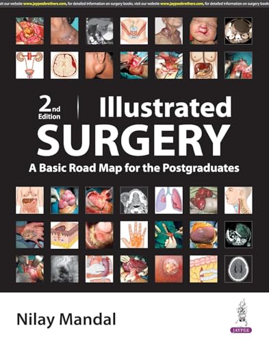 Image of ILLUSTRATED SURGERY A BASIC ROAD MAP FOR THE POSTGRADUATES