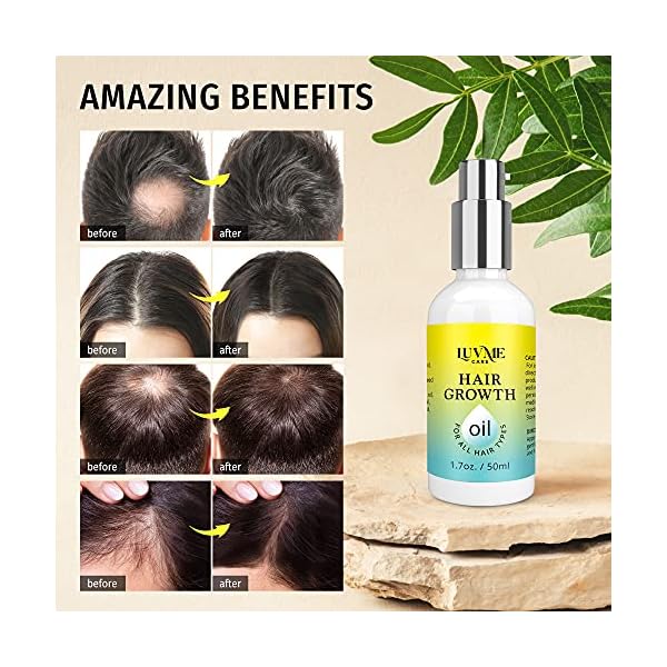 Luv-Me-Care-Hair-Growth-Oil-with-Caffeine-and-Biotin-2-Pack-Biotin-hair-growth-serum-for-Stronger-Thicker-Longer-Hair-17-oz Luv Me Care Hair Growth Oil with Biotin and Castor oil 2 Pack - Biotin hair growth serum for Stronger, Thicker, Longer Hair 1.7 oz