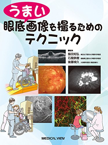 無料電子書籍アプリ うまい眼底画像を撮るためのテクニック バイ