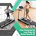 Treadmill Incline Riser Blocks, 4 PCS Walking Pad Incline Blocks, High-Density Rubber Top and Foam Base, Noise Reduction and Shock Absorption Mats, Ideal for Walking and Uphill Training at Home