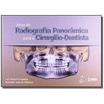 Capa do livro Atlas de Radiografia Panorâmica para o Cirurgião-Dentista