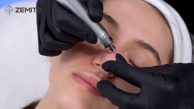 Amazon.com: Zemits DermeLuxx Pro | Hydrodermabrasion Oxygen Cryo