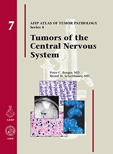 Compare Textbook Prices for Tumors of the Central Nervous System Afip Atlas of Tumor Pathology 1 Edition ISBN 9781933477015 by Burger, Peter C,Scheithauer, Bernd W