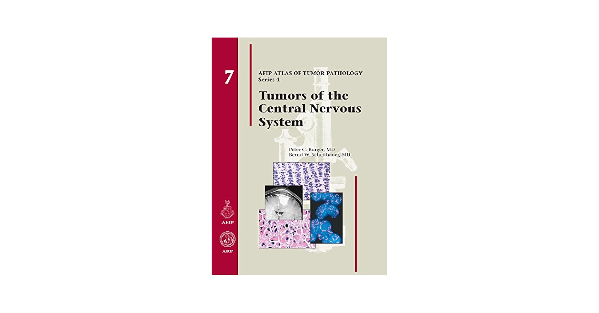 Tumors of the Central Nervous System (Afip Atlas of Tumor