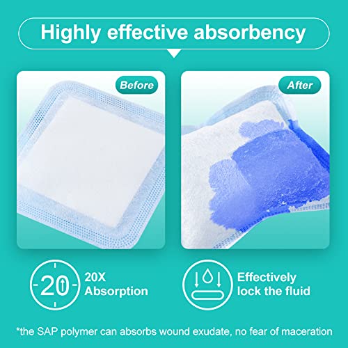 The 30 Best Wound Dressings of 2023 [Verified] Cherry Picks