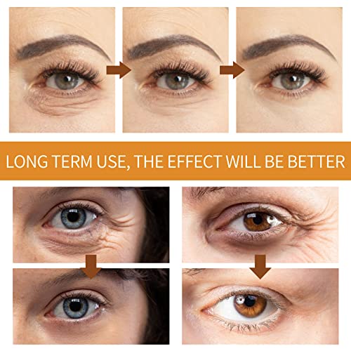Eye Cream Roller,Retinol Eye Cream,Under Eye Roller for Dark Circles and Puffiness,Reduce Wrinkles and Fine Lines,Hydrating Under Eye Cream,Relax Eyes Fatigue (1, One Size) - Image 5