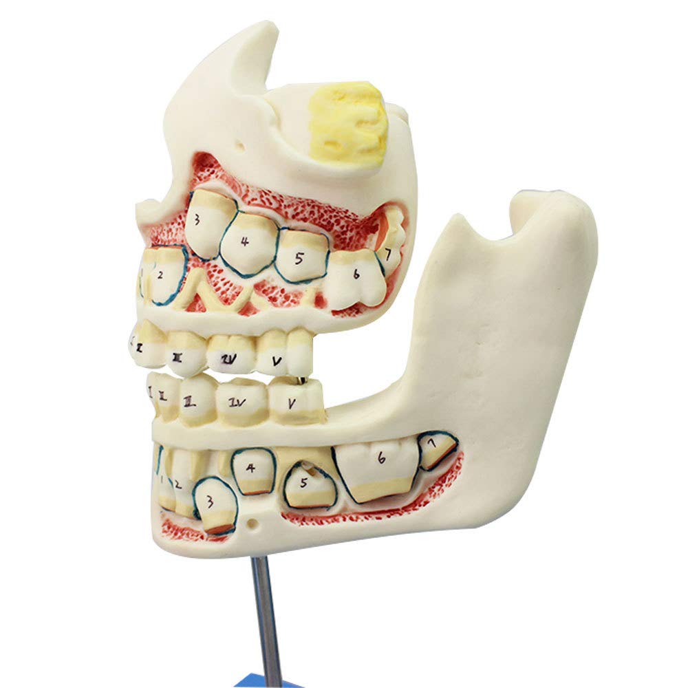 Denti Decidui Denti Permanenti Modello Sviluppo Dei Denti E Mascella Bambini Crescita Denti 4Stadi Modello Sviluppo Dentatura E Della Mascella Bambini Cura Dentale Orale Mascella Dentatura Denti