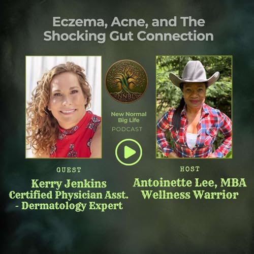 Eczema, Acne, and the Shocking Gut Connection in Skin Care