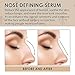 Nose Defining Serum, Nose Lift Shaping Oil, Nose Lift up Shaping Essence Oil, Nasal Bone Remodeling Serum, Nose Shrinker Shaper Serum, Shaping and Defining the Perfect Nose Line, 30ml (1PC)