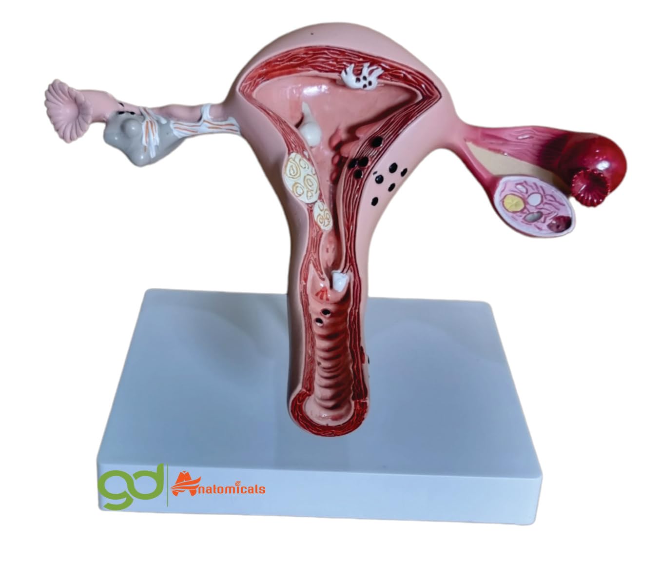 Uterus Anatomical Model: Lifesize Educational Tool Measuring 21x13x18cm - Comprehensive 3D Representation for Medical Training, Obstetrics Education, and Women's Health Awareness - Ideal for Medical Schools, Obstetrics and Gynecology Clinics, and Reproductive Health Education"