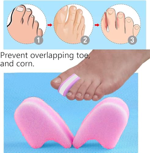 Image of 8 Pieces Premium Foam Toe Separators - Toe Spacers for Corn, Blister, and Hammer Toe Relief