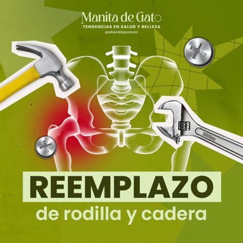 『Adi&oacute;s al dolor: lo &uacute;ltimo en reemplazo de cadera y rodilla explicado』のカバーアート