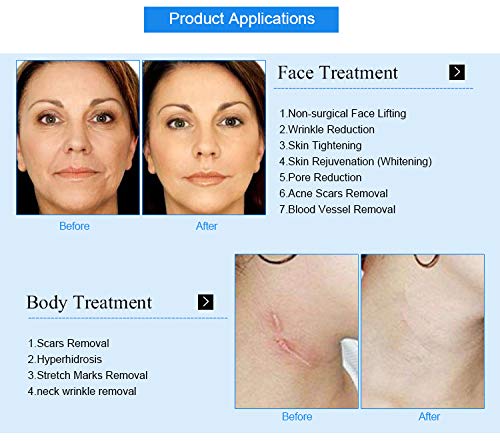 Miniatura 2 de Cartuchos de máquina de aguja RF cabezales de trabajo