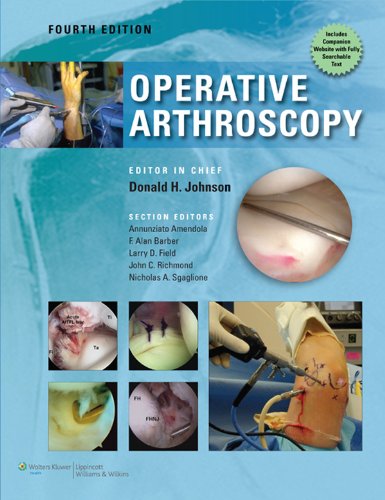 Télécharger Operative Arthroscopy (English Edition) Francais PDF