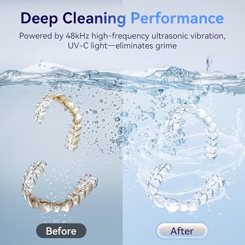 Image of Ultrasonic Retainer Cleaner Machine 48kHz, Dental Ultrasonic Care Cleaner | Ultrasonic Retainer Cleaner for Dentures, Aligners, Mouth Guards, Toothbrush Heads and Jewelry with 200ML Capacity