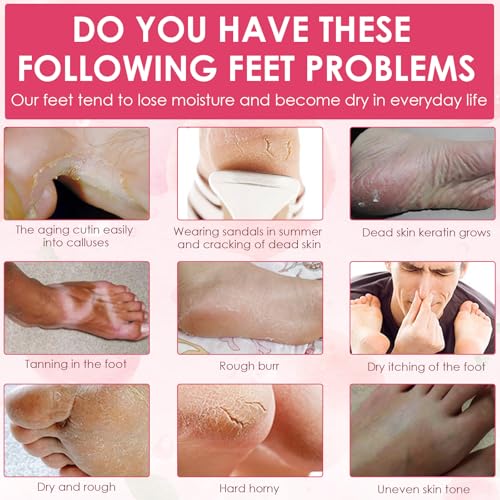 Mascarilla para pies, paquete de 2 calcetines para callos, calcetines para quitar callos, melocotón, repara los talones y elimina los callos secos de los pies muertos, calcetines anticallos - imagen 5