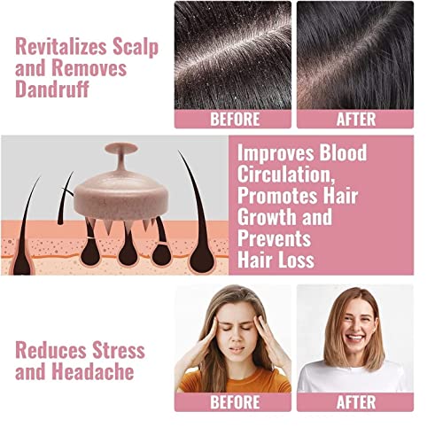 Image of QIQI Scalp Massager Shampoo Brush, Eco-friendly Wheat Straw body with Soft Silicon Bristles, Hair Scalp Scrubber, Scalp Exfoliator Dandruff Removal, Prevents Hair loss for Men, Women (AW35)