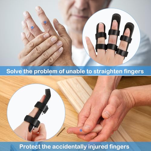 image for BBTO 10 Pieces Finger Splints Metal Padded Support Finger Stabilizer w