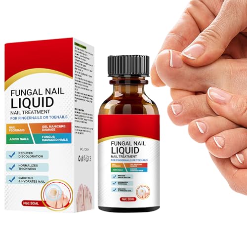 Tratamiento de uñas fúngicas - Solución de de uñas de alta potencia enriquecida | 30 ml de líquido antibacteriano para la reparación de uñas de los pies | Infección del pie a mano Escudo de uña