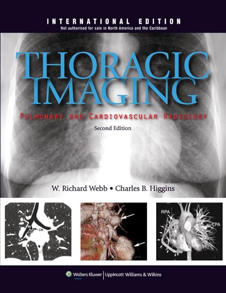 胸部の画像診断 Thoracic Imaging Thoracic Imaging : Pulmonary and Cardiovascular Radiology