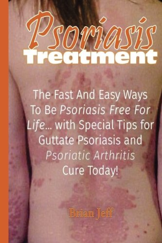 Psoriasis Treatment: The Fast and Easy Ways to Be Psoriasis Free for Life... with Special Tips for Guttate Psoriasis and Psoriatic Arthritis Cure Today!
