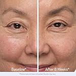 Obagi Nu-Cil Eyebrow Boosting Serum - Ultimate Eyebrow Growth Serum with Hyaluronic Acid - Dermatologist Approved for Thin, Patchy & Over-Tweezed Eyebrows - Fast Absorbing - 6ml - Image 3