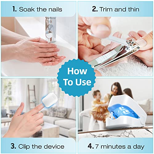 Resctol Nail Fungus Cleaning Laser Device For Toenail Fingernails & Onychomycosis, Home Use Nail-Fungus Remover By 905Nm Infrared Light + 470Nm Blue Light #TOP4