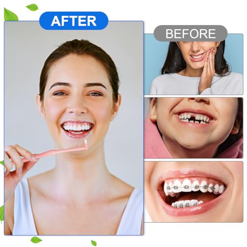 ACWOO Tuft Zahnbürste, 4 Stück Einbüschelbürste, Kleine Getuftet Bürste Weich Büschelzahnbürste Trimm Single Interdental Zwischenraum Bürste zur Detail Reinigung