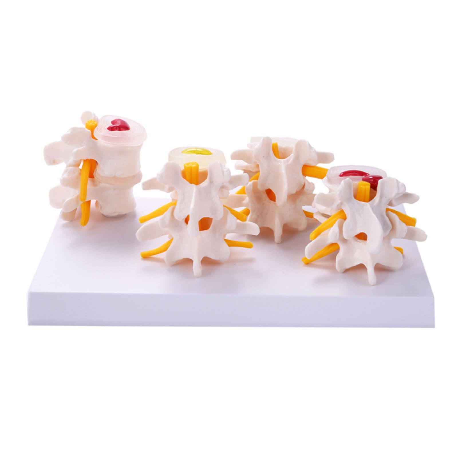 GTHTUHFD Classroom Study Human Anatomy Skeleton Spine 4 Stages Lumbar Vertebral Model Brain Skull Traumatic