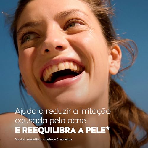 NIVEA Hidratante Facial Acne Control 50g - Ajuda a combater 99% das bactérias causadoras da acne