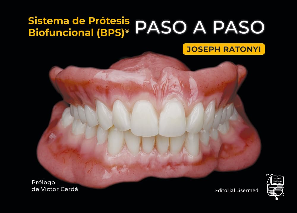 Sistema de Prótesis Biofuncional (BPS) Paso a Paso